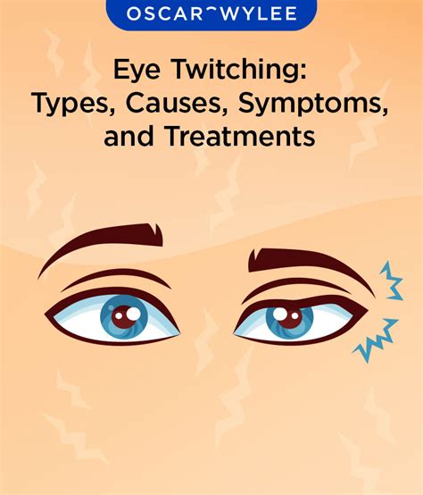 eye twitching wellbutrin|More.